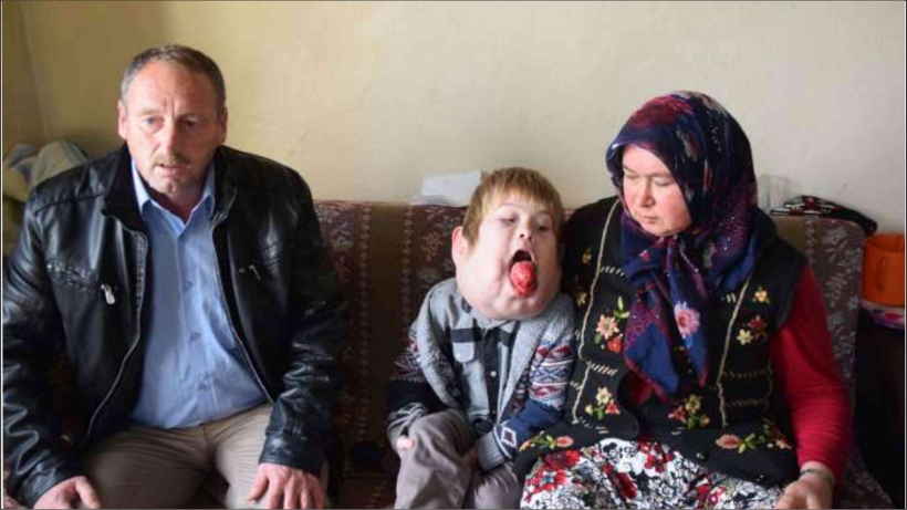 T&Uuml;RKİYE'NİN Y&Uuml;REĞİNİ BURKAN &Ccedil;OCUK AMELİYAT OLDU